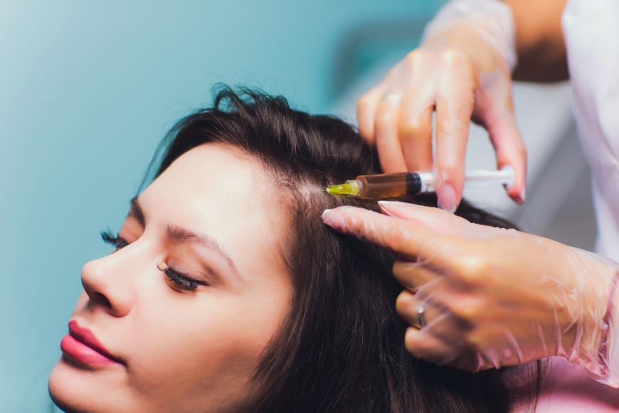 Best PRP therapy for hair loss in Dubai PRP treatment for thinning hair in Dubai